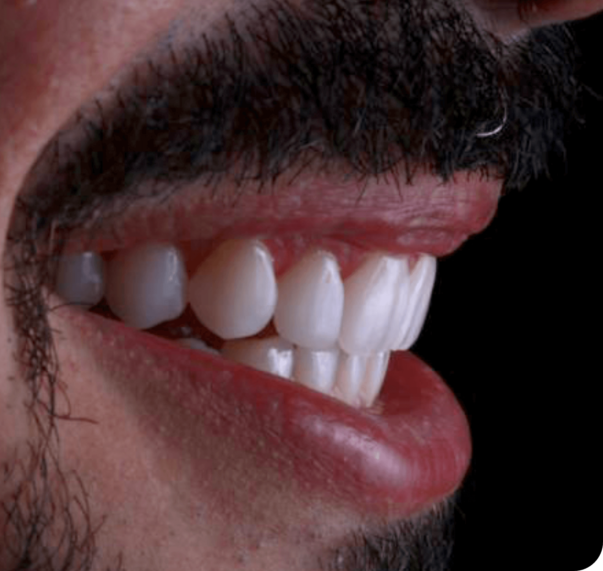 man_teeth_2-min